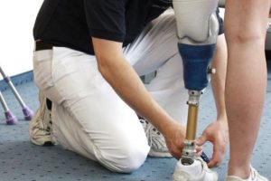 Решение ФАС против участника сговора на торгах по оказанию протезно-ортопедической помощи в Мособласти устояло в апелляции
